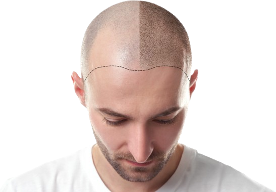6408c8dbbf4f98c1e82fb895 removebg preview