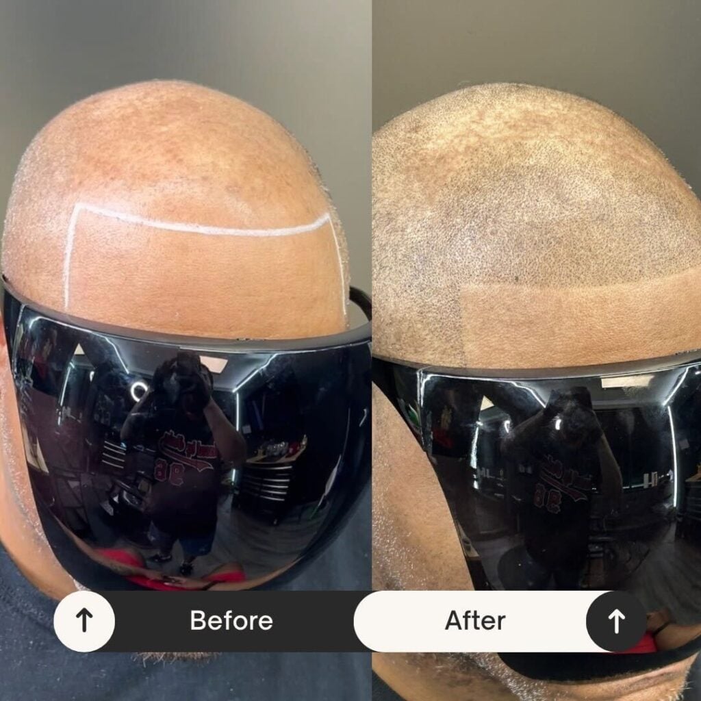 beige minimalist skincare before and after instagram post (2)