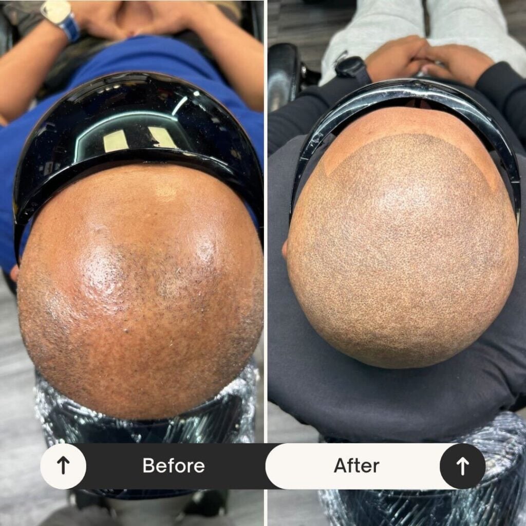 beige minimalist skincare before and after instagram post (1)